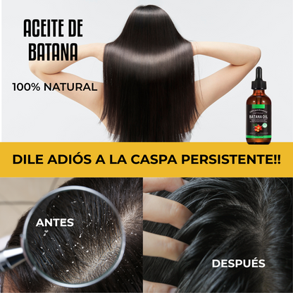 Aceite de Batana